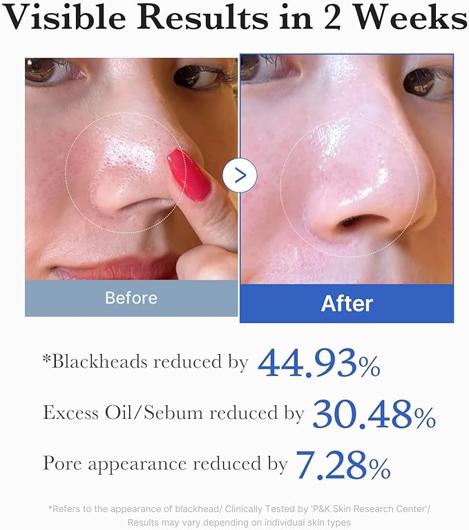 MEDICUBE Zero Pore Pads 2.0 (70 pads)