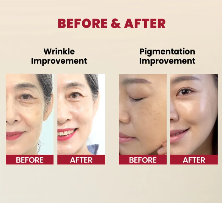 KSECRET - SEOUL 1988 Serum : Retinal Liposome 2% + Black Ginseng