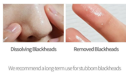 Celimax Derma Nature Fresh Blackhead Jojoba Cleansing Oil